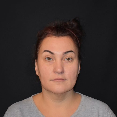 lift-Michal-15A-aspect-ratio-500-500