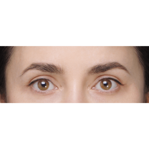 miszczyk-lift-brwi-3A-aspect-ratio-500-500