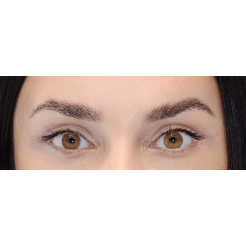 miszczyk-lift-brwi-3B-aspect-ratio-500-500