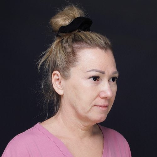 mniejsze-1C-aspect-ratio-500-500