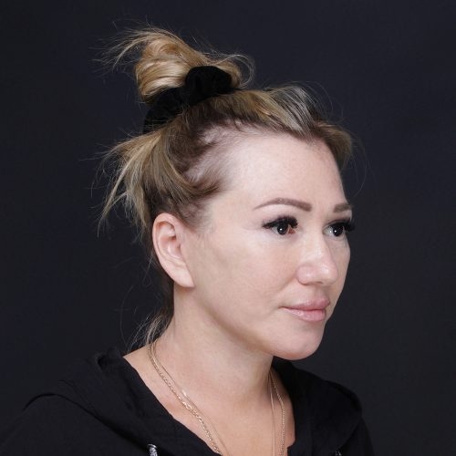 mniejsze-1D-aspect-ratio-500-500