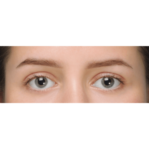 miszczyk-lift-brwi-8A-aspect-ratio-500-500