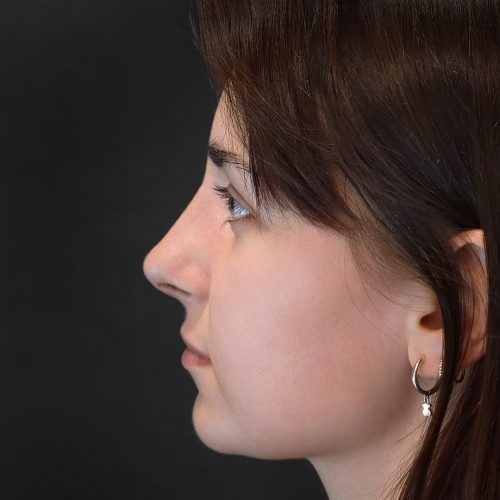 Daria-nos-F-aspect-ratio-500-500