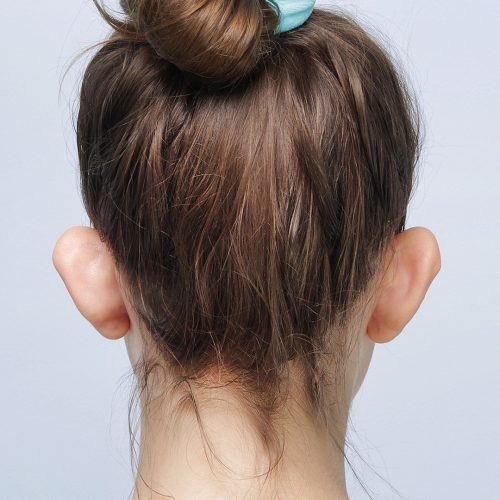 Burkacka-plastyka-uszu-2A-aspect-ratio-500-500