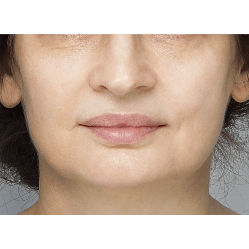 miszczyk-policzek-2AB-1A-aspect-ratio-500-500