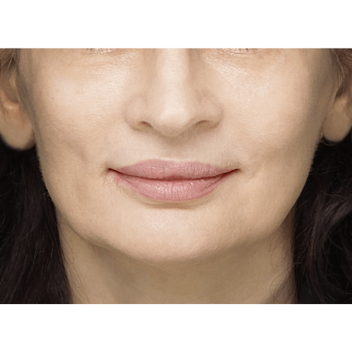 miszczyk-policzek-2AB-1B-aspect-ratio-500-500