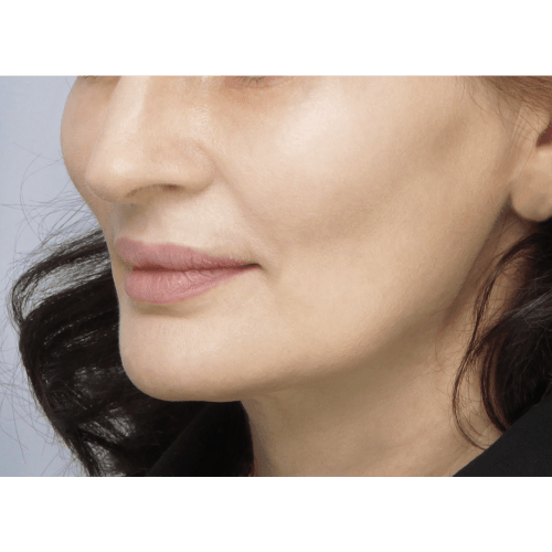 miszczyk-policzek-2AB-2B-aspect-ratio-500-500