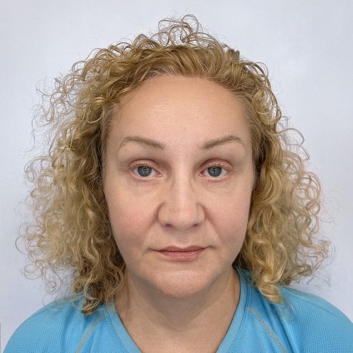 miszczyk-policzek-3b-aspect-ratio-500-500