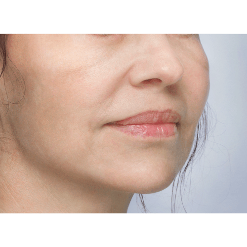 miszczyk-policzek-49117-2A-aspect-ratio-500-500