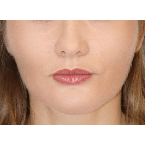 miszczyk-policzek-4b-aspect-ratio-500-500