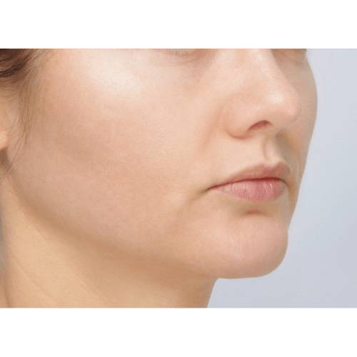 miszczyk-policzek-4c-aspect-ratio-500-500