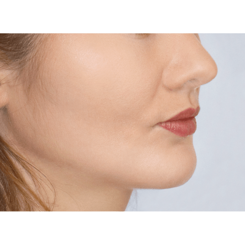 miszczyk-policzek-4d-aspect-ratio-500-500