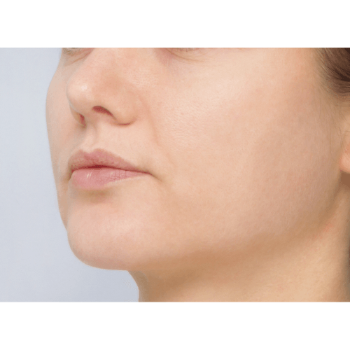 miszczyk-policzek-4e-aspect-ratio-500-500