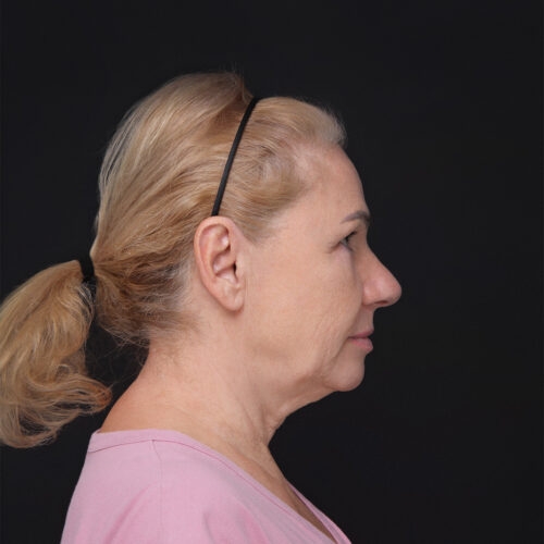 daria-dpfl–id64693-7a-aspect-ratio-500-500