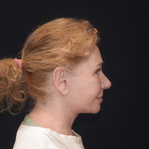 daria-dpfl–id64693-7b-aspect-ratio-500-500