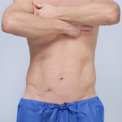 ferenc-brzuch-65546-6a-aspect-ratio-500-500