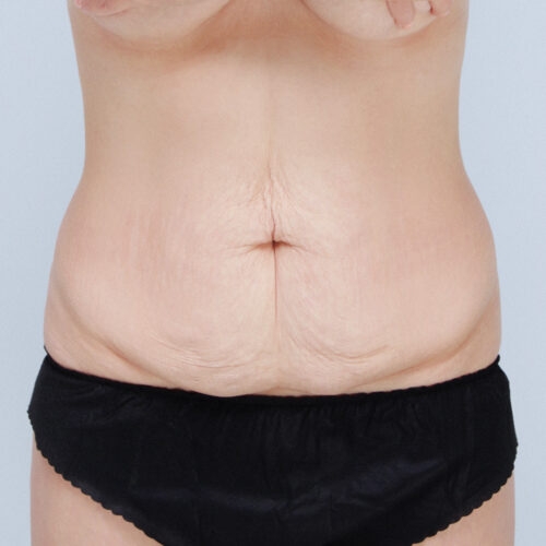 daria-brzuch-id-61809-17a-aspect-ratio-500-500