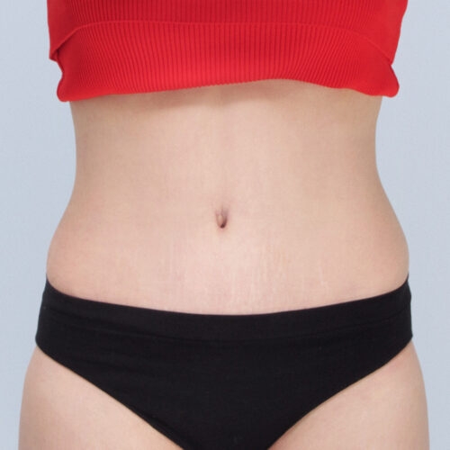 daria-brzuch-id-61809-17b-aspect-ratio-500-500