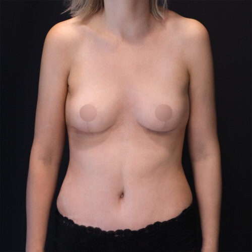 daria-piersi-brzuch-id62982-b-aspect-ratio-500-500