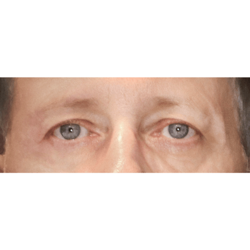 daria-powieki-id-68721-5a-aspect-ratio-500-500