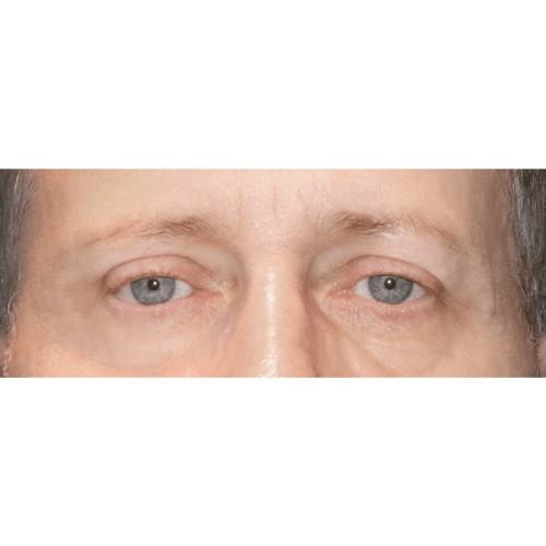 daria-powieki-id-68721-5b-aspect-ratio-500-500