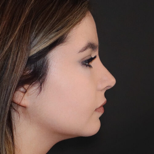 michal-nos-id57025-32b-aspect-ratio-500-500