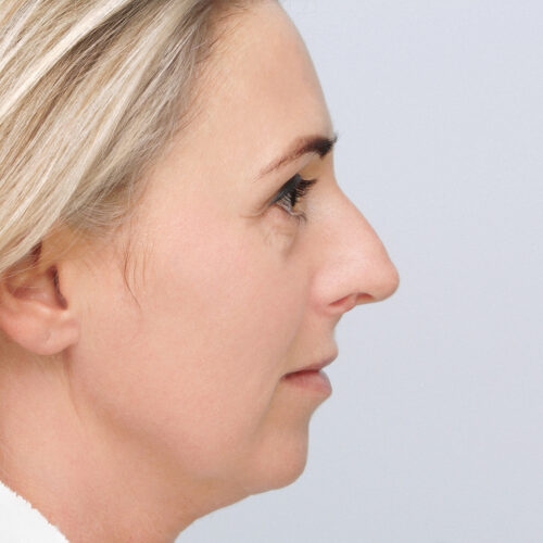 michal-nos-id58579-33a-aspect-ratio-500-500