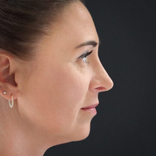 michal-nos-id58579-33b-aspect-ratio-500-500