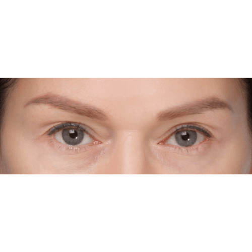 michal-powieki-gorne-id59681-8a-aspect-ratio-500-500