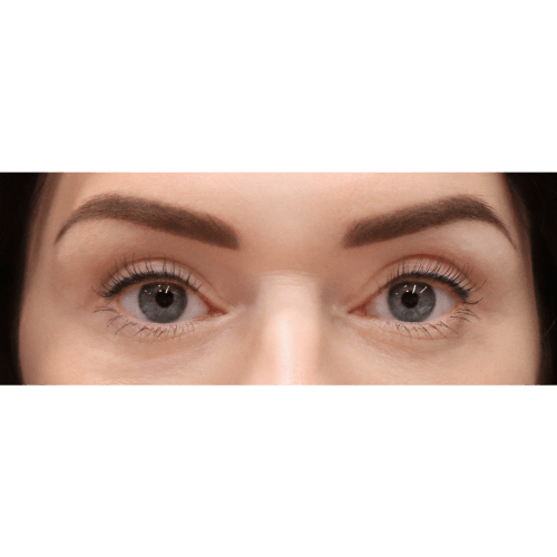 michal-powieki-gorne-id59681-8b-aspect-ratio-500-500