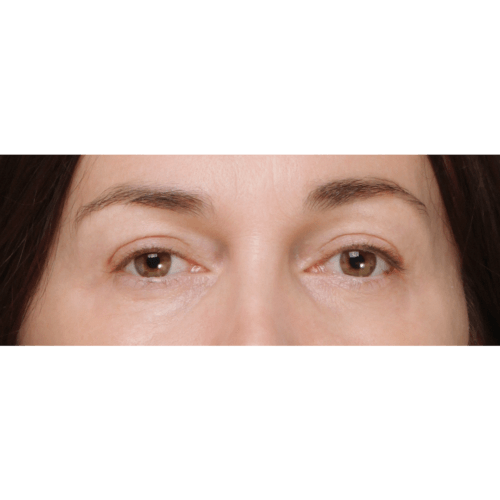 michal-powieki-lift-id58042-9a-aspect-ratio-500-500