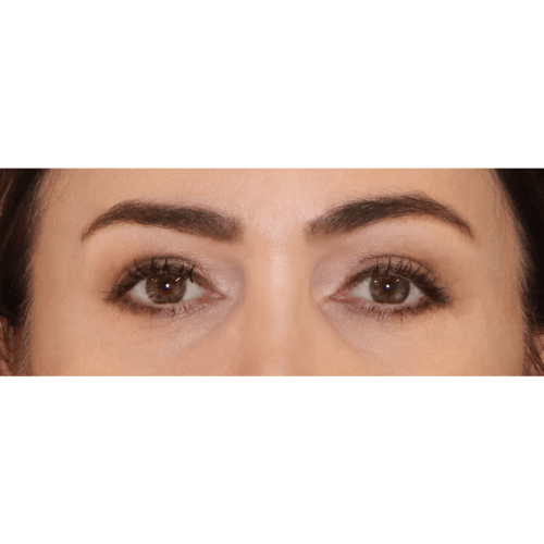 michal-powieki-lift-id58042-9b-aspect-ratio-500-500