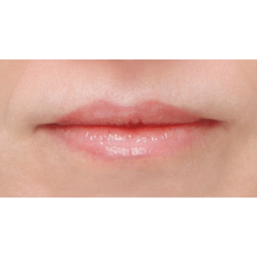 miszczyk-lip-lift-2d-aspect-ratio-500-500