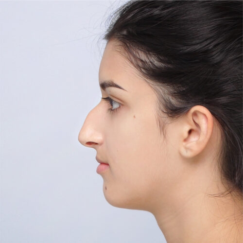 12a-aspect-ratio-500-500