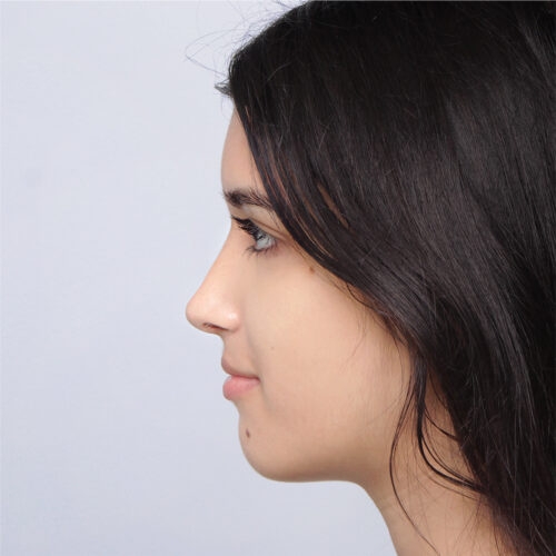 12b-aspect-ratio-500-500