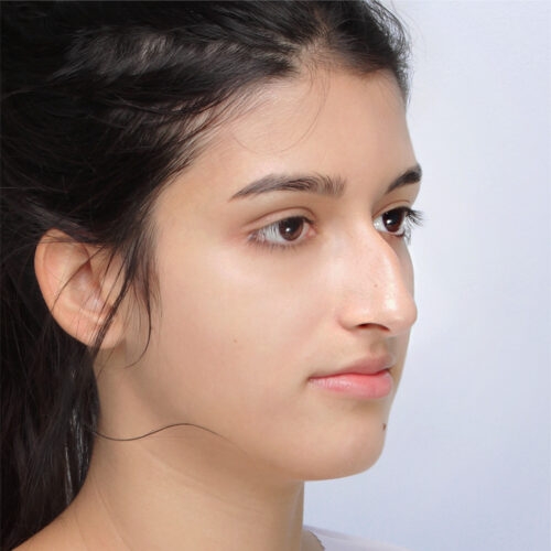 13a-aspect-ratio-500-500