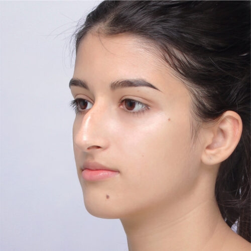 14a-aspect-ratio-500-500