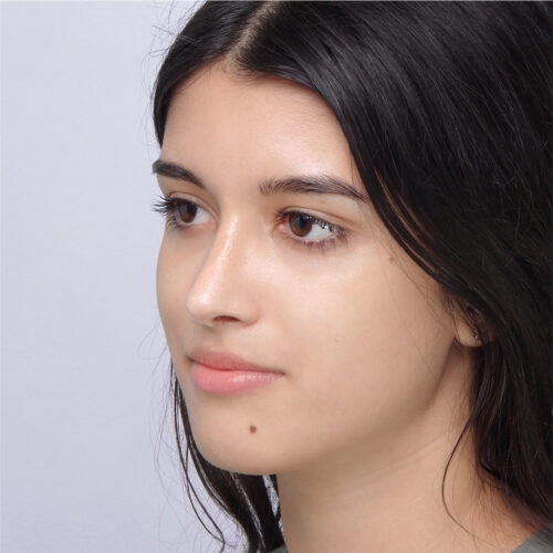 14b-aspect-ratio-500-500