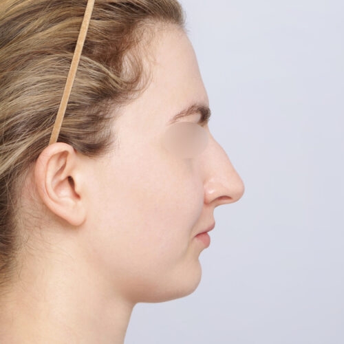 15a-aspect-ratio-500-500