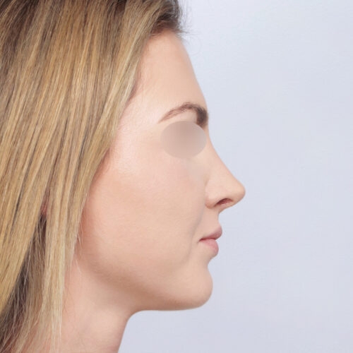 15b-aspect-ratio-500-500