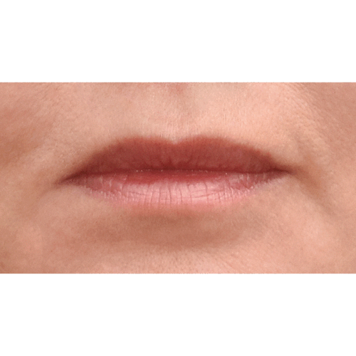 1d-aspect-ratio-500-500