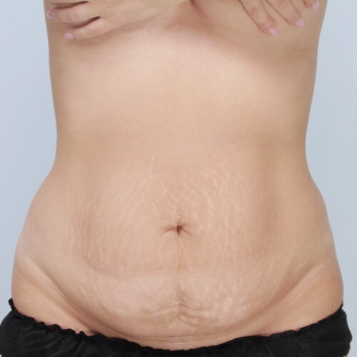 daria-brzuch-id-59388-18a-aspect-ratio-500-500