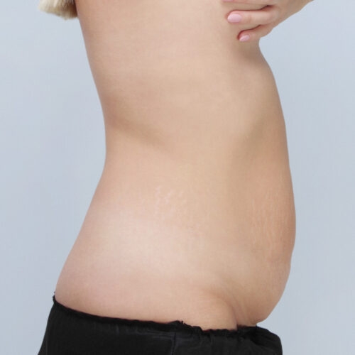 daria-brzuch-id-59388-18c-aspect-ratio-500-500