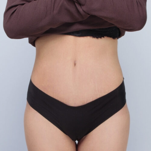 daria-brzuch-id-61581-19b-aspect-ratio-500-500