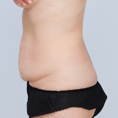 daria-brzuch-id-61809-17g-aspect-ratio-500-500