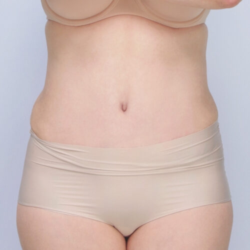 daria-brzuch-id-62143-20b-aspect-ratio-500-500