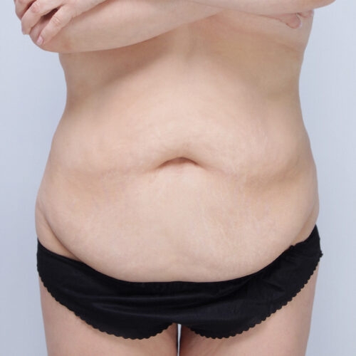 daria-brzuch-id-63153-22a-aspect-ratio-500-500