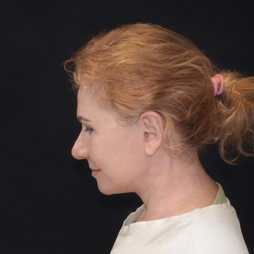 daria-dpfl–id64693-9f-aspect-ratio-500-500