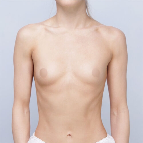 daria-implanty-63182-26a-aspect-ratio-500-500