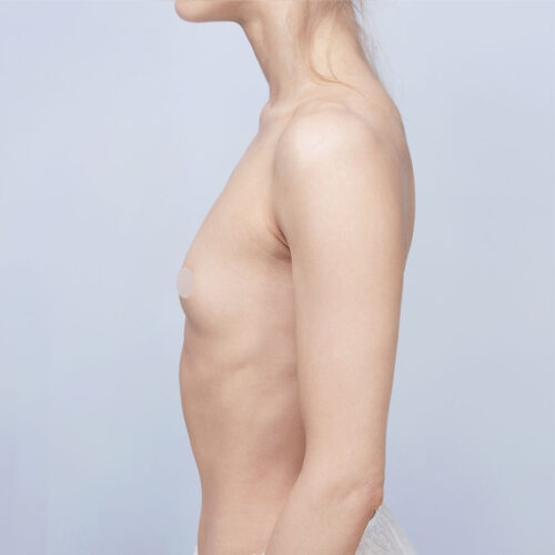 daria-implanty-63182-26f-aspect-ratio-500-500